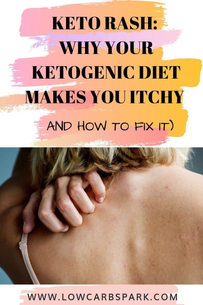 Keto rash is similar to eczema or dermatitis and usually occurs on the neck, shoulders, back, chest, torso, axial areas, and very rarely occurs on the face and extremities of the body. Some of these effects can be tiredness, stomach ache, dizziness, and even keto rash. Learn what is the keto rash, what triggers eat and how to cure it! #ketorash